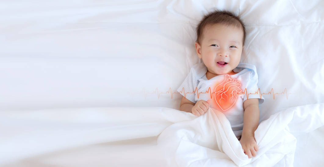 Penyakit Jantung Bawaan Berdampak pada Gangguan Tumbuh Kembang Anak