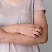 11 Masalah Kulit yang Rentan Dialami Orang dengan Diabetes