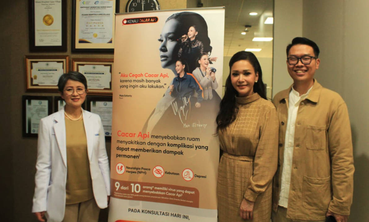 Mums, Waspada dan Cegah Penyakit Cacar Api yang Bisa Berdampak Seumur Hidup