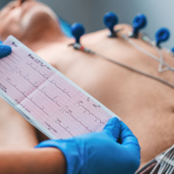 1 dari 10 orang yang Ikuti EKG Screening, Teridentifikasi Aritmia