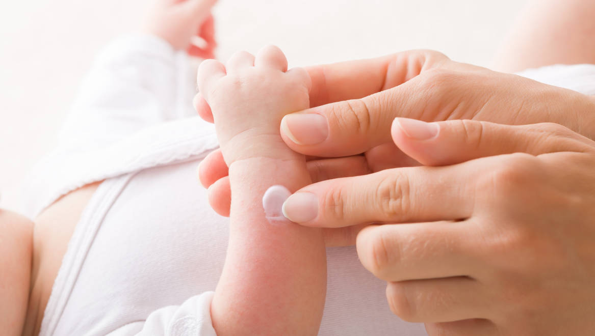 Solusi Mudah Mengatasi Masalah Kulit Bayi dan Anak