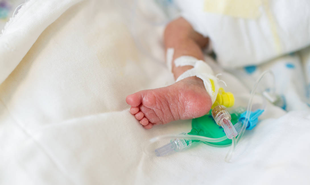  8 Cara Merawat Bayi Prematur di Rumah