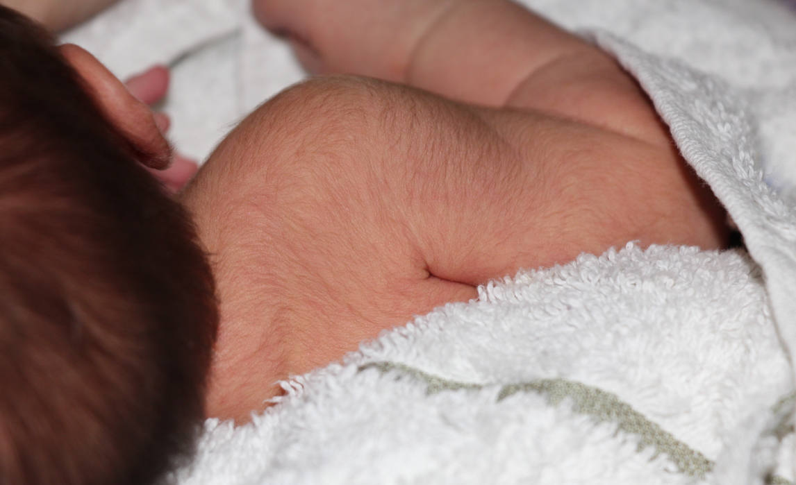  Penyebab Banyak Rambut di Tubuh Bayi Baru Lahir