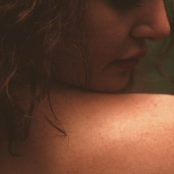 Mengenal Rubella dan Vaksin MR