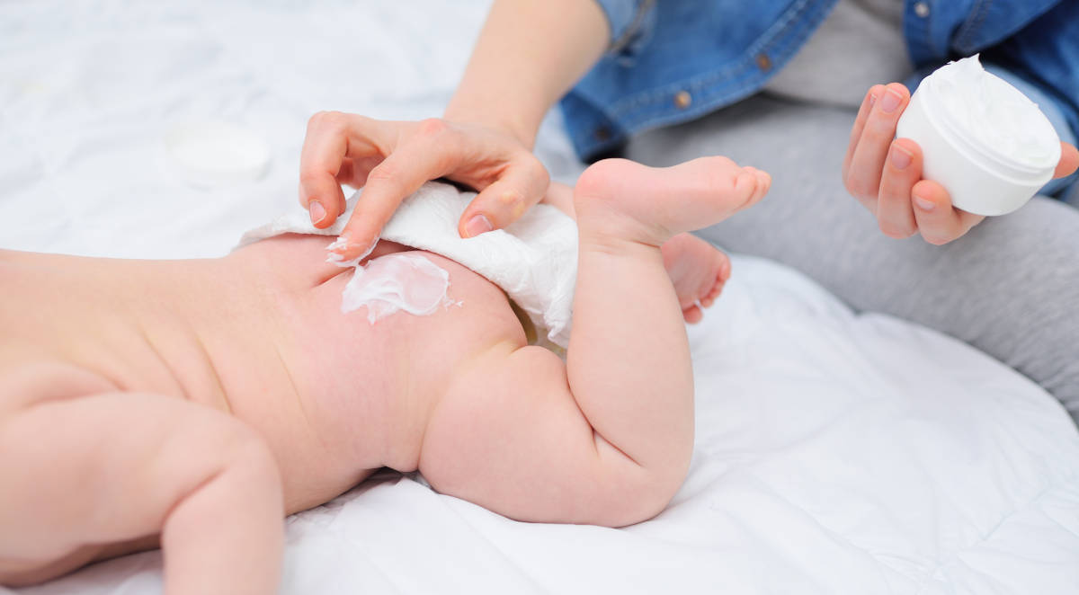 Ibu sedang mengoleskan krim ruam popok pada bayi