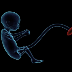 Waspada Solusio Plasenta pada Ibu Hamil