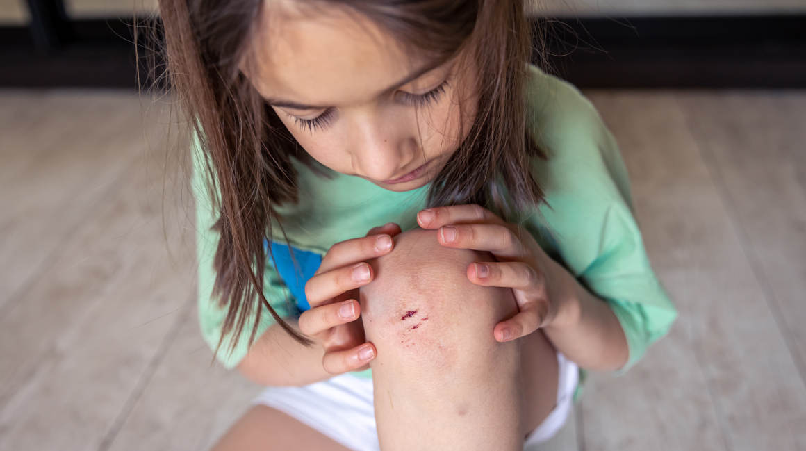 Jenis-jenis Penyakit Kulit Bernanah pada Anak