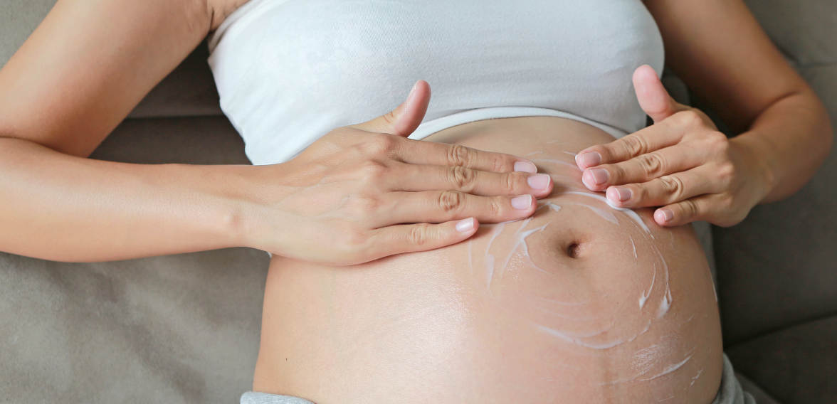 8 Cara Mencegah Muncul Stretch Mark saat Hamil 