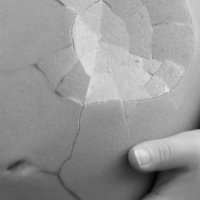 Tentang Keguguran dan Bagaimana Mengatasi Dampak Emosionalnya