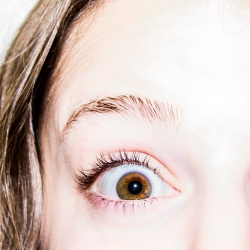 Glaukoma, Penyebab Kebutaan Kedua Setelah Katarak