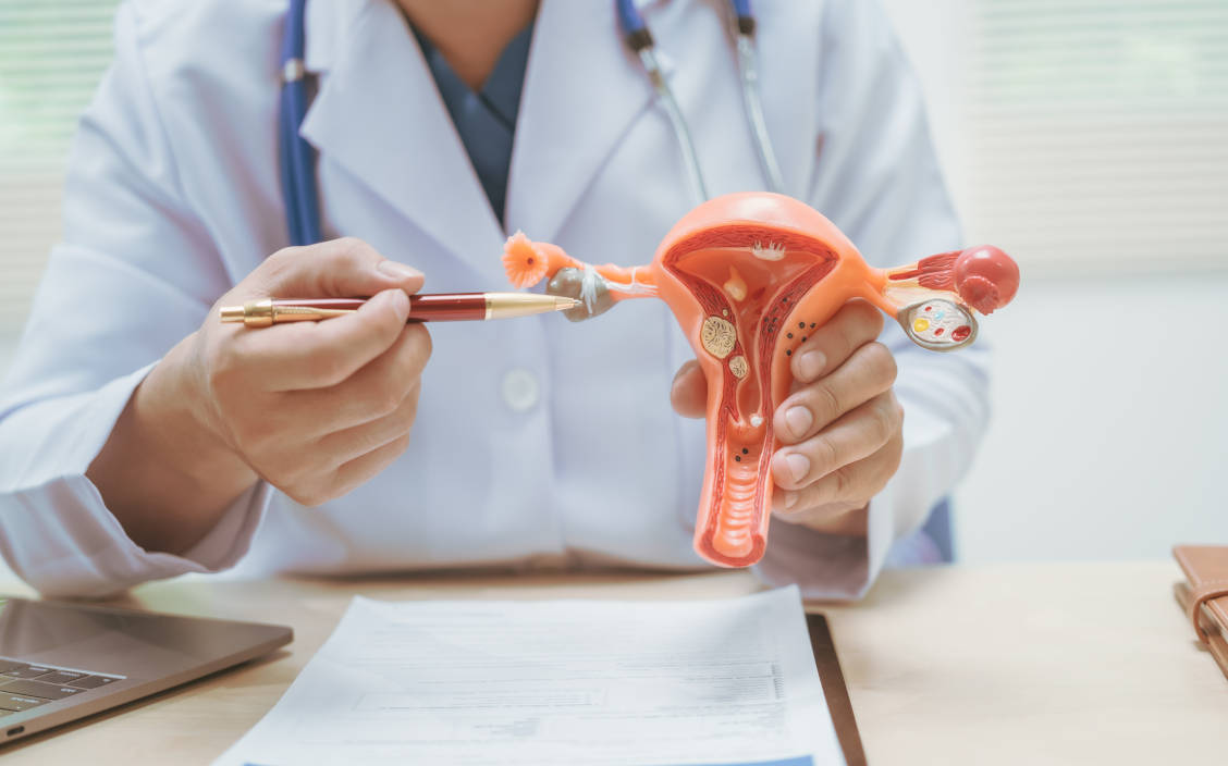 Dokter sedang menunjukkan penyakit kista rahim