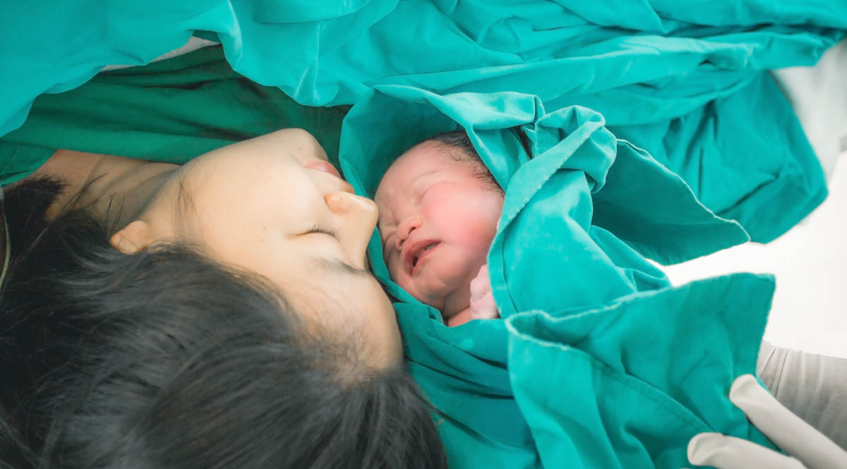 Mengenal Metode ERACS pada Persalinan Caesar