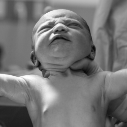 Pentingnya Tes APGAR untuk Bayi Baru Lahir