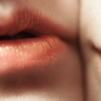 Herpes Oral: Penularan, Gejala, dan Pencegahan