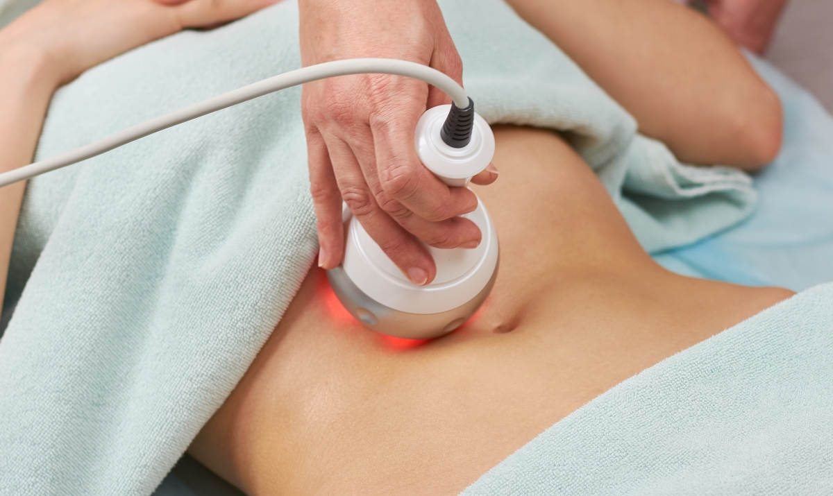 6 Cara Menghilangkan Stretch Mark Setelah Melahirkan