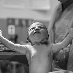 Plasenta Macet Enggak Keluar Saat Persalinan, Ini Penyebabnya!