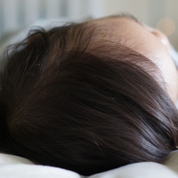 Cara Tepat Menghilangkan Kutu Rambut