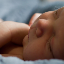 Kenali Penyakit Kuning pada Bayi Baru Lahir