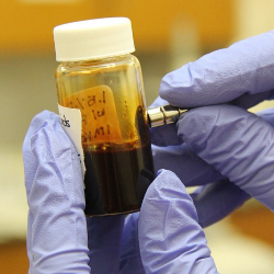 8 Fakta Penting Seputar Hepatitis