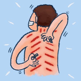 Dibalik Nikmatnya Kerokan Saat Masuk Angin