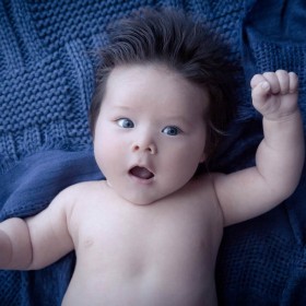 Lakukan 5 Cara Ini untuk Mencegah Obesitas Anak