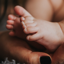 11 Masalah Kulit yang Sering Menyerang Bayi Baru Lahir