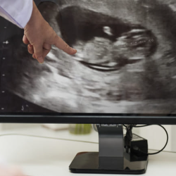 Pilih USG 2D, 3D, atau 4D? Masing-masing Ada Fungsinya Lho!