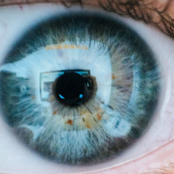 Kenali Ablasio Retina, Salah Satu Penyebab Kebutaan