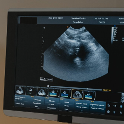 Kenapa Air Ketuban Berwarna Hijau? Apakah Berbahaya?