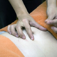 Akupunktur Bisa Mengurangi Nyeri Kanker