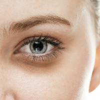 Mata Panda? Jangan-jangan Itu Allergic Shiners!