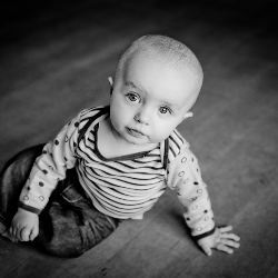 Wah, Si Kecil Juga Bisa Mengalami Kebotakan, Lho!