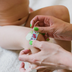 Si Kecil Alergi dengan Plester Penutup Luka, Harus Bagaimana?