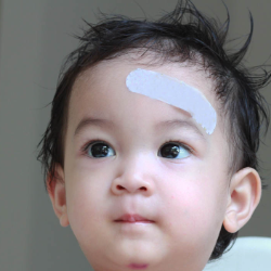 Anak Jatuh Terbentur, Begini Cara Perawatannya!