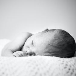 Caput Succedaneum, Trauma Fisik yang Membuat Kepala Bayi Baru Lahir Bengkak