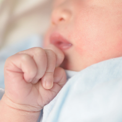 Bisa Menghambat Proses Menyusui, Apa Itu Lip Tie dan Bagaimana Penanganannya?