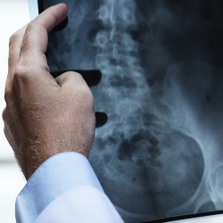 Penyakit Ginjal Kronik dan Akut, Apa Bedanya?