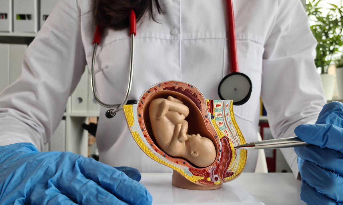 Dokter menjelaskan letak plasenta dan rahim copot