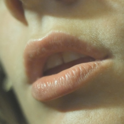 Bau Mulut? Waspada Penyakit di Bawah Ini!