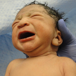 15.000 Bayi Baru Lahir Alami Penyakit Jantung Bawaan, Apakah Bisa Dicegah?