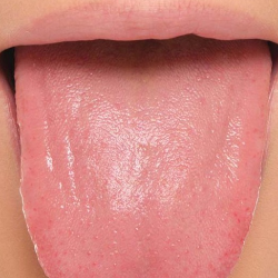 Sering Mengobati Luka Menggunakan Air Liur? Ketahui Hal Ini Dulu!