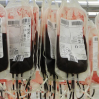 Beda Tipe Anemia, Beda Pula Penanganannya!