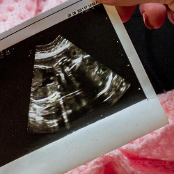 Benarkah Buang Air Kecil Setelah Berhubungan Bisa Cegah Kehamilan?