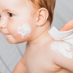 Atasi Biang Keringat pada Anak agar Tidak Infeksi