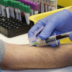 Bolehkah Penderita Diabetes Donor Darah?