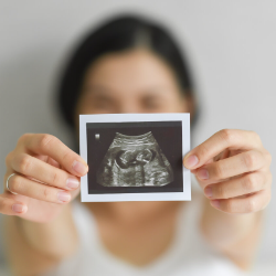 Bukan Mitos, Berat Badan Berlebih Pengaruhi Kesuburan!