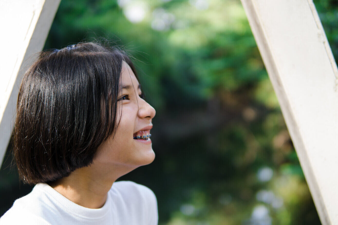 Di Usia Berapa Anak Boleh Pakai Kawat Gigi?