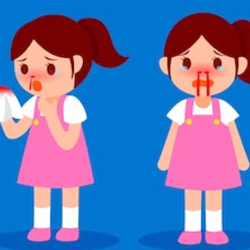 Begini Cara Mengatasi dan Mencegah Mimisan!