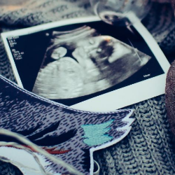 Mums, Begini Cara Mengatasi Mual saat Hamil!