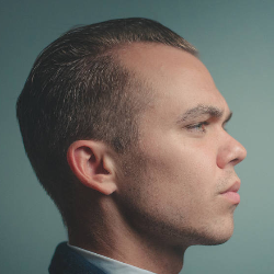 Ini Cara Mengatasi Rambut Rontok Bagi Pria